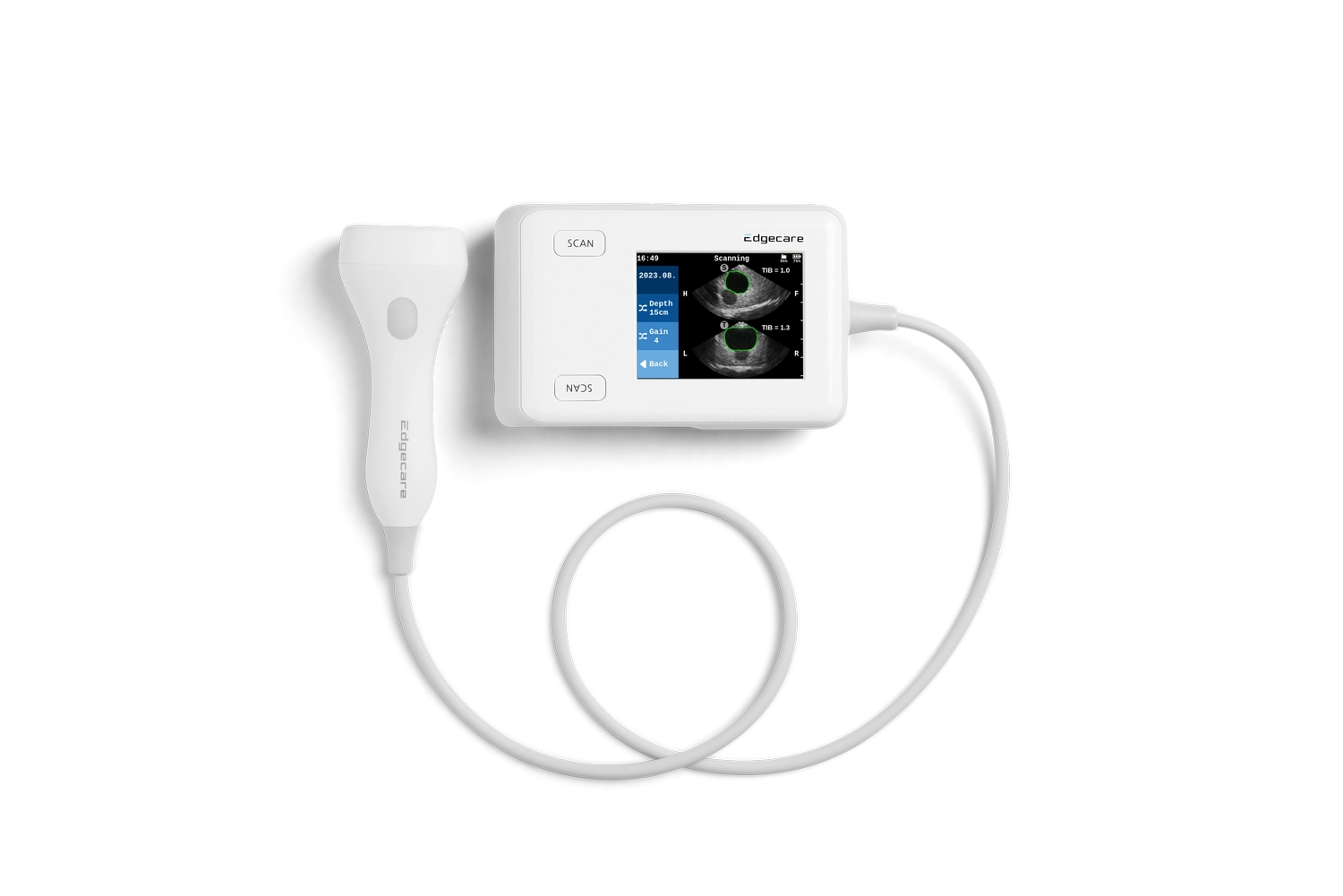 UH 10 Blasenscanner -Edgecare biomed-concept by Laserneedle GmbH — Gesundheit — Berlin