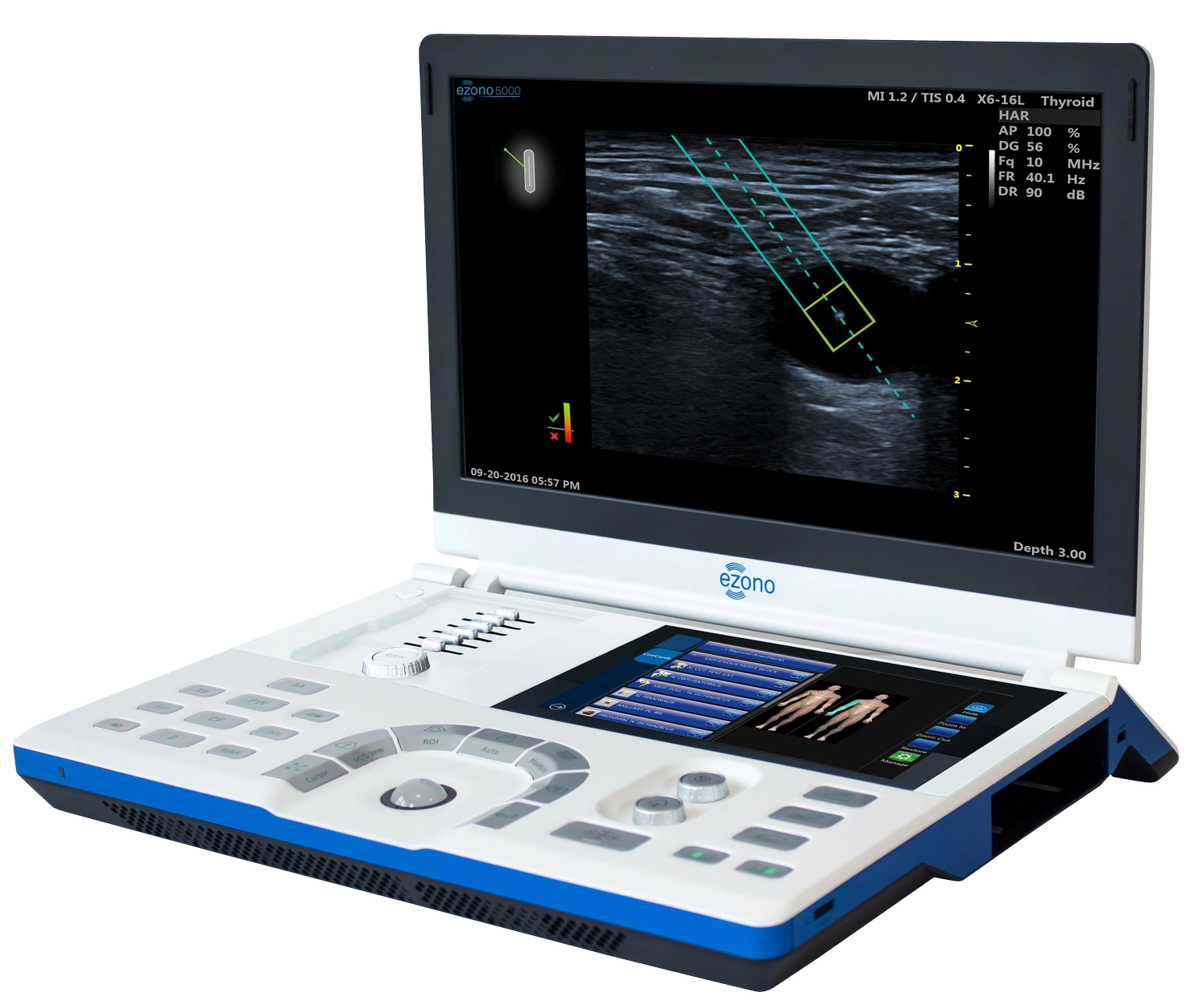 ezono 5000 Ultraschallgerät biomed-concept by Laserneedle GmbH — Gesundheit — Berlin