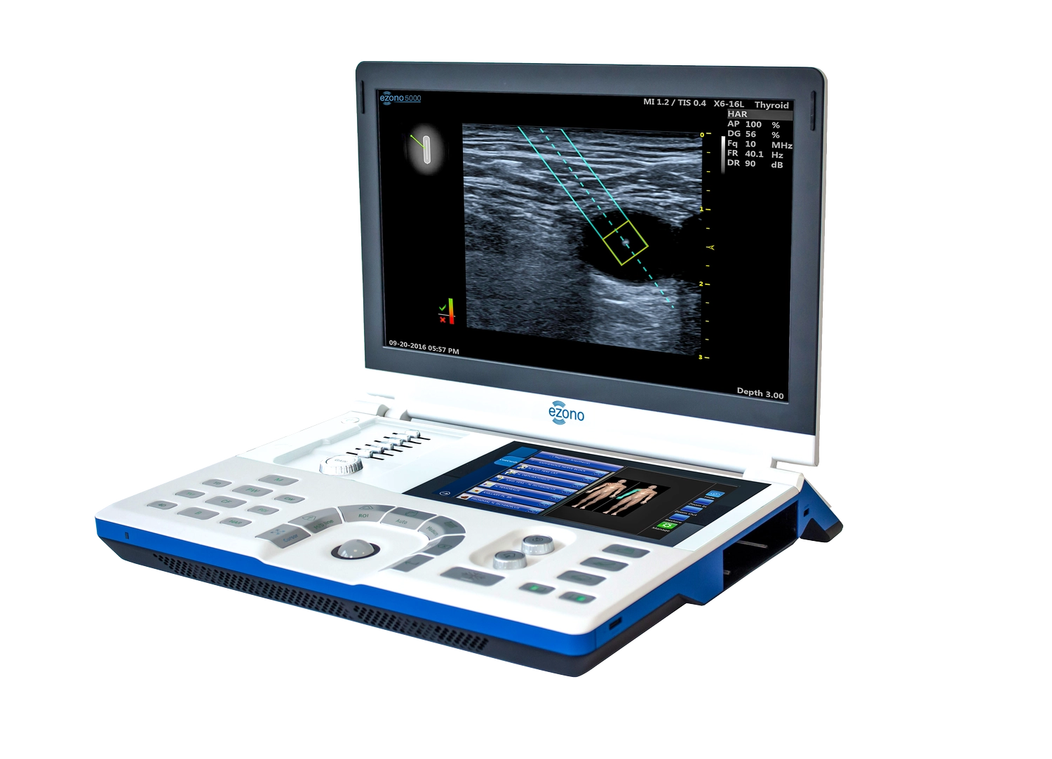 ezono 5000 Ultraschallgerät biomed-concept by Laserneedle GmbH — Gesundheit — Berlin